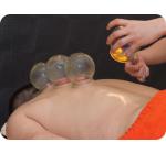 拔罐 Cupping (Ba Guan)