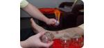 足部拔罐  Foot Cupping
