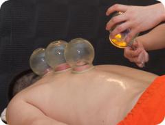 拔罐 Cupping (Ba Guan)